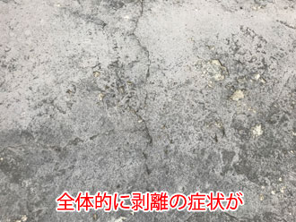 全体的に剥離の症状が